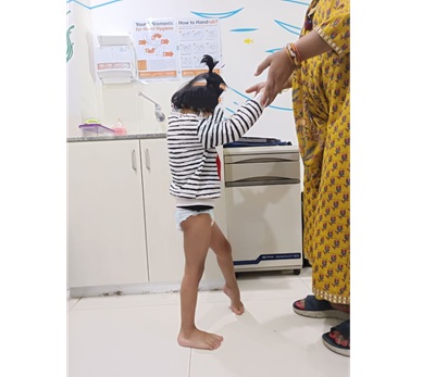 Mumbai doctors give new lease of life to 3-year-old child living with cerebral palsy 5 Pre operation